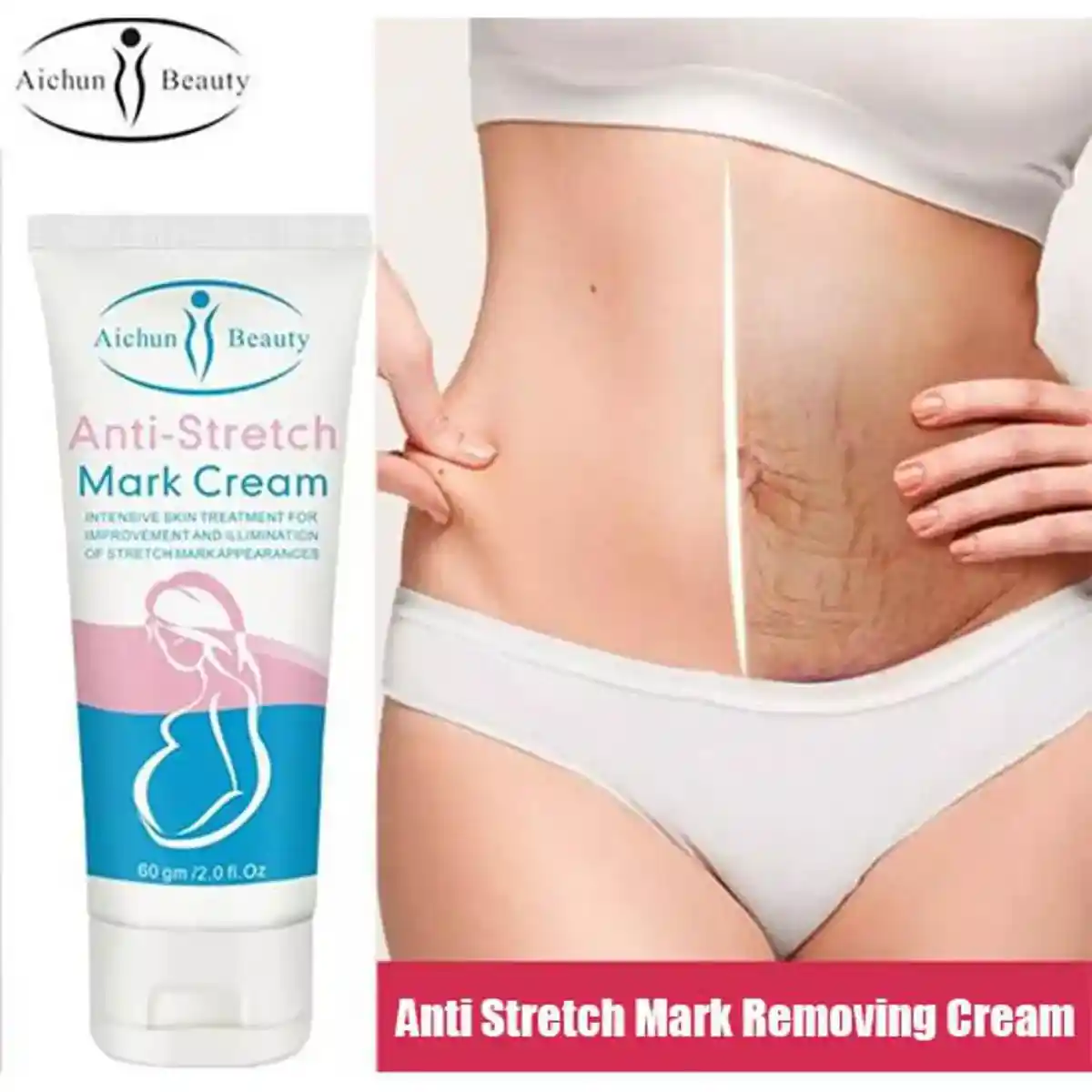 Anti Stretch Mark Cream (60gm)